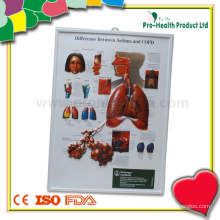 Difference Between Asthma And COPD 3D Anatomical Chart Wholesale